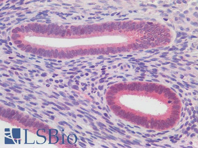 ATG16L1 / ATG16L Antibody - Human Uterus, Endrometrium: Formalin-Fixed, Paraffin-Embedded (FFPE)