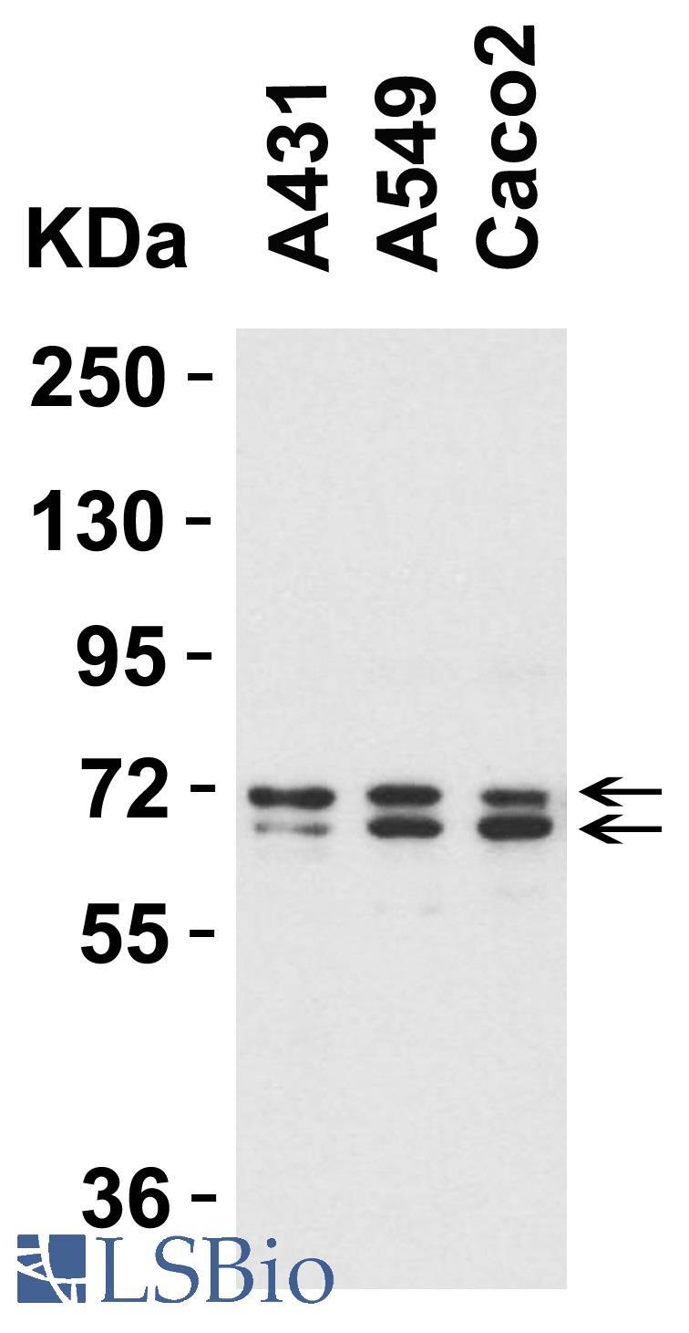ATG16L1 / ATG16L Antibody - Western blot analysis of Anti-ATG16L1 antibody (LS-B2724, 1µg/ml; 15 µg of lysate per lane). Lane 1: A431 cell line. Lane 2: A549 cell line. Lane 3: Caco2 cell line. Antibody produced  bands at ~68 kDa (Isoform 1), and ~66 kDa (isoform 2)