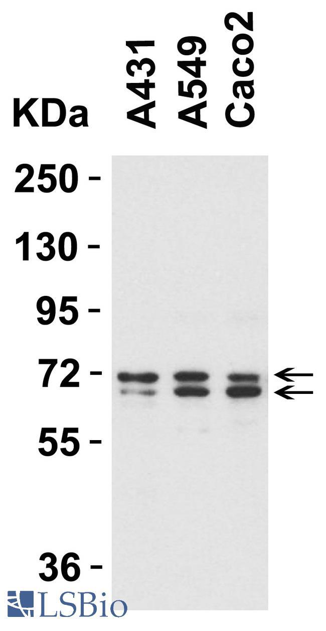 ATG16L1 / ATG16L Antibody - Western blot analysis of Anti-ATG16L1 antibody (LS-B2724, 1µg/ml; 15 µg of lysate per lane). Lane 1: A431 cell line. Lane 2: A549 cell line. Lane 3: Caco2 cell line. Antibody produced  bands at ~68 kDa (Isoform 1), and ~66 kDa (isoform 2)
