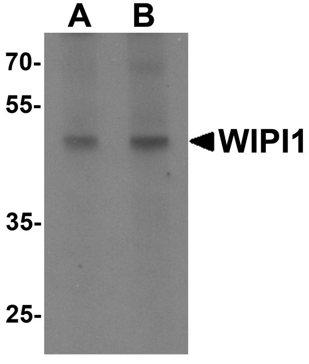 ATG18 / WIPI1 Antibody - Western blot analysis of WIPI1 in rat colon tissue lysate with WIPI1 antibody at (A) 1 and (B) 2 ug/ml.