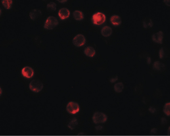 ATG2B Antibody - Immunofluorescence of ATG2B in K562 cells with ATG2B antibody at 20 ug/ml.