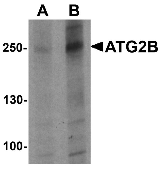 ATG2B Antibody - Western blot analysis of ATG2B in K562 cell lysate with ATG2B antibody at (A) 1 and (B) 2 ug/ml