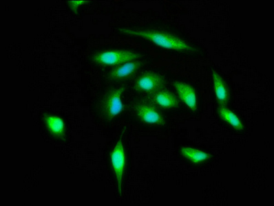 ATG3 Antibody - Immunofluorescence staining of Hela cells with ATG3 Antibody at 1:400, counter-stained with DAPI. The cells were fixed in 4% formaldehyde, permeabilized using 0.2% Triton X-100 and blocked in 10% normal Goat Serum. The cells were then incubated with the antibody overnight at 4°C. The secondary antibody was Alexa Fluor 488-congugated AffiniPure Goat Anti-Rabbit IgG(H+L).