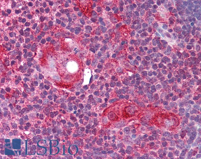 ATG9A Antibody - Anti-ATG9A antibody IHC of human thymus. Immunohistochemistry of formalin-fixed, paraffin-embedded tissue after heat-induced antigen retrieval. Antibody concentration 5 ug/ml.  This image was taken for the unconjugated form of this product. Other forms have not been tested.