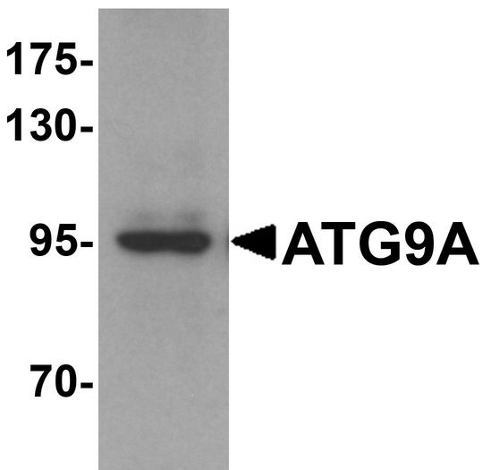 ATG9A Antibody - Western blot analysis of ATG9A in mouse heart tissue lysate with ATG9A antibody at 1 ug/ml.