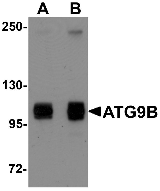 ATG9B Antibody - Western blot analysis of ATG9B in HeLa cell lysate with ATG9B antibody at (A) 1 and (B) 2 ug/ml.