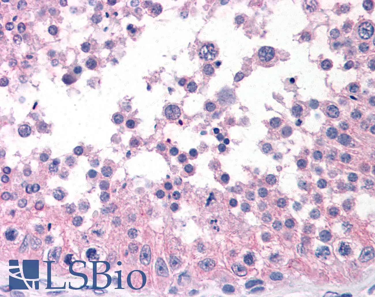 ATM Antibody - Anti-ATM antibody IHC of human testis. Immunohistochemistry of formalin-fixed, paraffin-embedded tissue after heat-induced antigen retrieval. Antibody concentration 20 ug/ml.  This image was taken for the unconjugated form of this product. Other forms have not been tested.