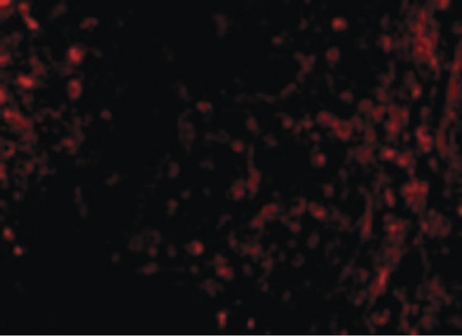 ATM Antibody - Immunofluorescence of ATM in Human Lymph Node cells with ATM antibody at 10 ug/ml.