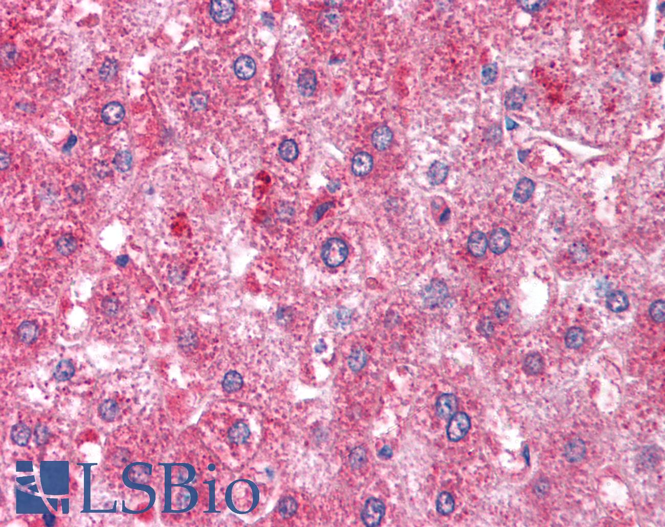 ATM Antibody - Anti-ATM antibody IHC of human liver. Immunohistochemistry of formalin-fixed, paraffin-embedded tissue after heat-induced antigen retrieval. Antibody concentration 2 ug/ml.