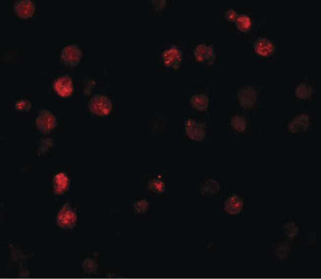 ATP11A Antibody - Immunofluorescence of ATP11A in K562 cells with ATP11A antibody at 20 ug/ml.