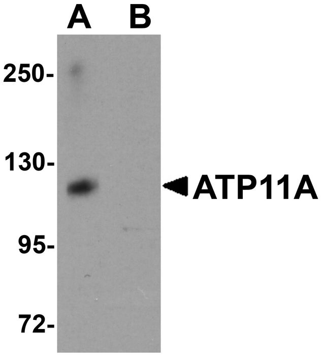 ATP11A Antibody - Western blot analysis of ATP11A in K562 cell tissue lysate with ATP11A antibody at 1 ug/ml in (A) the absence and (B) the presence of blocking peptide.