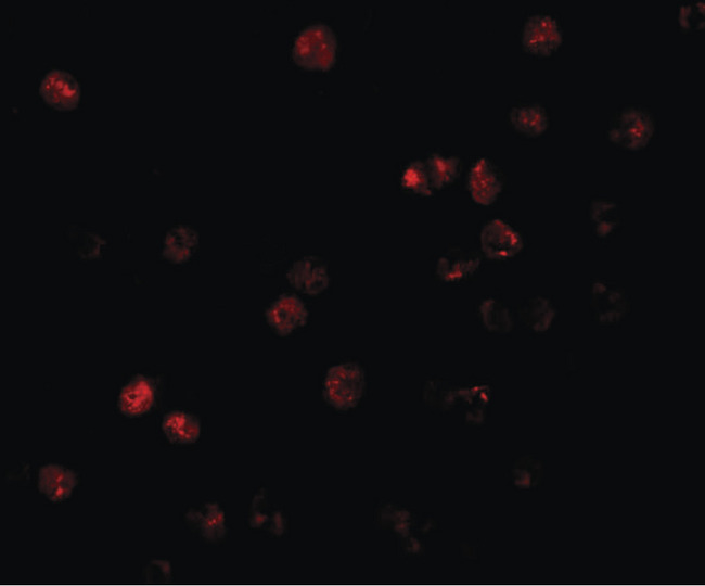 ATP11B Antibody - Immunofluorescence of ATP11B in K562 cells with ATP11B antibody at 20 ug/ml.