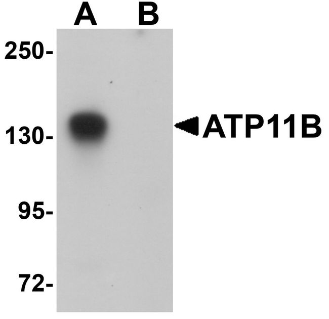ATP11B Antibody - Western blot analysis of ATP11B in K562 cell tissue lysate with ATP11B antibody at 1 ug/ml in (A) the absence and (B) the presence of blocking peptide.