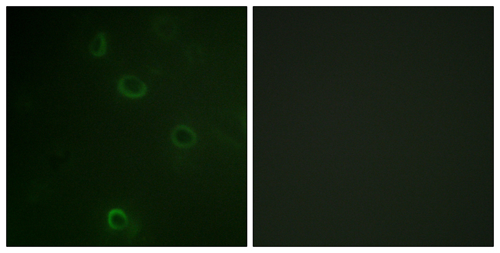 ATP1A1 Antibody - Immunofluorescence analysis of COS7 cells, using ATPase Antibody. The picture on the right is blocked with the synthesized peptide.