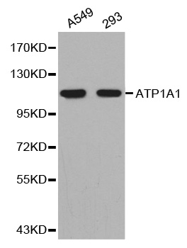 ATP1A1 Antibody - Western blot analysis of extracts of A549 cell and 293 cell line, using ATP1A1 antibody.