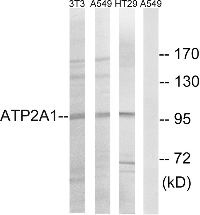 ATP2A1 / SERCA1 Antibody - Western blot analysis of lysates from HT-29, A549, and NIH/3T3 cells, using ATP2A1 Antibody. The lane on the right is blocked with the synthesized peptide.