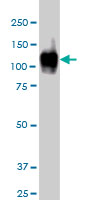 ATP2A1 / SERCA1 Antibody - ATP2A1 monoclonal antibody, clone 1B11 Western blot of ATP2A1 expression in A-431.