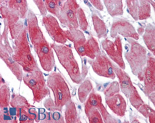 ATP2A1 / SERCA1 Antibody - Anti-SERCA1 antibody IHC of human heart. Immunohistochemistry of formalin-fixed, paraffin-embedded tissue after heat-induced antigen retrieval. Antibody concentration 5 ug/ml.