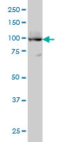 ATP2A3 / SERCA3 Antibody - Western blot of ATP2A3 expression in HL-60 cell lysate.