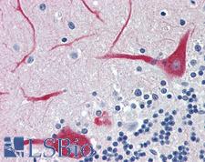 ATP2A3 / SERCA3 Antibody - Anti-ATP2A3 / SERCA3 antibody IHC of human brain, cerebellum. Immunohistochemistry of formalin-fixed, paraffin-embedded tissue after heat-induced antigen retrieval. Antibody concentration 5 ug/ml.