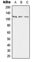 ATP2B2 / PMCA2 Antibody - Western blot analysis of PMCA2 expression in HEK293T (A); mouse brain (B); rat brain (C) whole cell lysates.