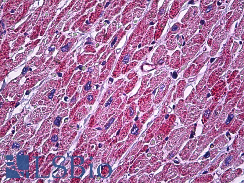ATP5A1 / ATP Synthase Alpha Antibody - Anti-ATP5A1 antibody IHC of human heart. Immunohistochemistry of formalin-fixed, paraffin-embedded tissue after heat-induced antigen retrieval. Antibody dilution 1:200.