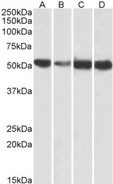 ATP5A1 / ATP Synthase Alpha Antibody - ATP5A1 antibody (0.01 ug/ml) staining of Human (A), fetal Mouse (B), adult Mouse (C) and adult Rat (D) Heart lysates (35 ug protein in RIPA buffer). Primary incubation was 1 hour. Detected by chemiluminescence.