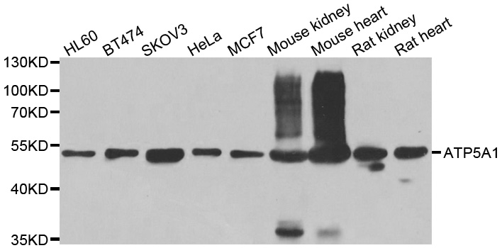 ATP5A1 / ATP Synthase Alpha Antibody - Western blot analysis of extracts of various cell lines, using ATP5A1 antibody.