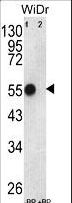 ATP5B / ATP Synthase Beta Antibody - Western blot of ATP5B Antibody antibody pre-incubated without(lane 1) and with(lane 2) blocking peptide in WiDr cell line lysate. ATP5B (arrow) was detected using the purified antibody.