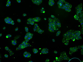 ATP5B / ATP Synthase Beta Antibody - Immunofluorescent staining of HepG2 cells using anti-ATP5B mouse monoclonal antibody.