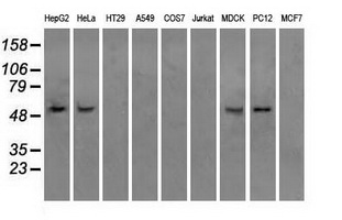 ATP5B / ATP Synthase Beta Antibody - Western blot of extracts (35 ug) from 9 different cell lines by using anti-ATP5B monoclonal antibody.