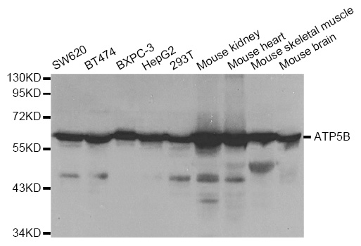 ATP5B / ATP Synthase Beta Antibody - Western blot analysis of extracts of various cell lines, using ATP5B antibody.