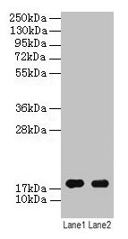 ATP5D Antibody - Western blot All lanes: ATP synthase subunit delta, mitochondrial antibody at 2µg/ml Lane 1: EC109 whole cell lysate Lane 2: 293T whole cell lysate Secondary Goat polyclonal to rabbit IgG at 1/15000 dilution Predicted band size: 60, 55, 58 kDa Observed band size: 36 kDa