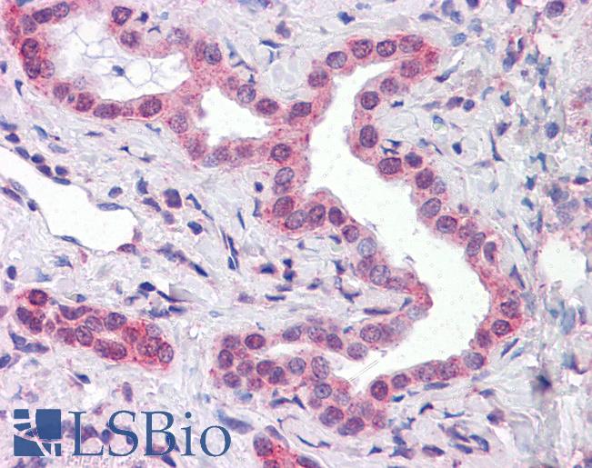 ATP5E Antibody - Anti-ATP5E antibody IHC of human liver, bile ducts. Immunohistochemistry of formalin-fixed, paraffin-embedded tissue after heat-induced antigen retrieval. Antibody concentration 5 ug/ml.