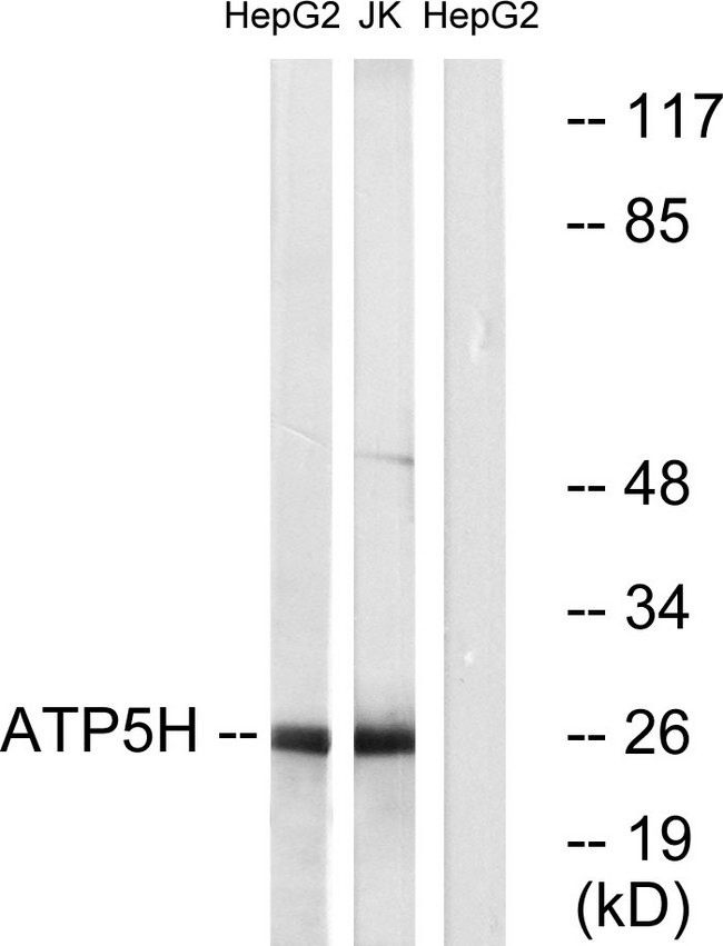 ATP5H Antibody - Western blot analysis of lysates from HepG2 and Jurkat cells, using ATP5H Antibody. The lane on the right is blocked with the synthesized peptide.