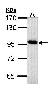 ATP6V0A4 Antibody - Sample (30 ug of whole cell lysate). A: Hep G2 . 7.5% SDS PAGE. ATP6V0A4 antibody diluted at 1:3000.