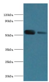 ATP6V1B1 Antibody - Western blot. All lanes: V-type proton ATPase subunit B, kidney isoform antibody at 7 ug/ml. Lane 1: mouse kidney tissue. Lane 2: 293T whole cell lysate. Secondary antibody: Goat polyclonal to rabbit at 1:10000 dilution. Predicted band size: 57 kDa. Observed band size: 57 kDa.