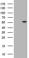 ATP6V1B2 Antibody - HEK293T cells were transfected with the pCMV6-ENTRY control (Left lane) or pCMV6-ENTRY ATP6V1B2 (Right lane) cDNA for 48 hrs and lysed. Equivalent amounts of cell lysates (5 ug per lane) were separated by SDS-PAGE and immunoblotted with anti-ATP6V1B2.