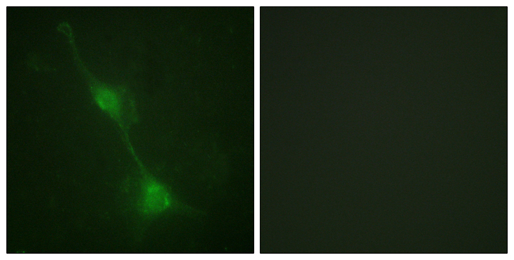 ATXN1 / SCA1 Antibody - Immunofluorescence analysis of NIH/3T3 cells, using Ataxin 1 Antibody. The picture on the right is blocked with the synthesized peptide.