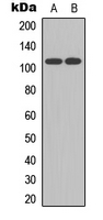 ATXN1 / SCA1 Antibody - Western blot analysis of Ataxin 1 (pS775) expression in HEK293T (A); mouse brain (B) whole cell lysates.