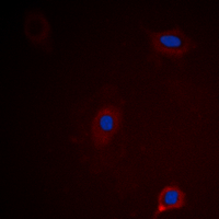 ATXN1 / SCA1 Antibody - Immunofluorescent analysis of Ataxin 1 (pS775) staining in HEK293 cells. Formalin-fixed cells were permeabilized with 0.1% Triton X-100 in TBS for 5-10 minutes and blocked with 3% BSA-PBS for 30 minutes at room temperature. Cells were probed with the primary antibody in 3% BSA-PBS and incubated overnight at 4 deg C in a humidified chamber. Cells were washed with PBST and incubated with a DyLight 594-conjugated secondary antibody (red) in PBS at room temperature in the dark. DAPI was used to stain the cell nuclei (blue).