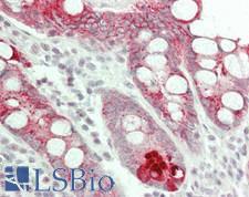 ATXN1 / SCA1 Antibody - Human Small Intestine: Formalin-Fixed, Paraffin-Embedded (FFPE)