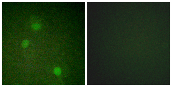 AURKB / Aurora-B Antibody - Immunofluorescence analysis of HeLa cells, using AurB Antibody. The picture on the right is blocked with the synthesized peptide.