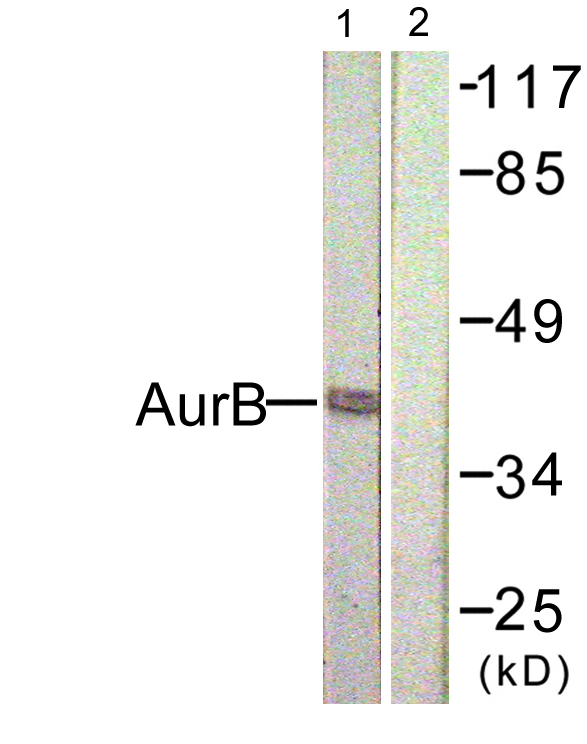 AURKB / Aurora-B Antibody - Western blot analysis of lysates from COS7 cells, treated with Nocodazole 1ug/ml 16h, using AurB Antibody. The lane on the right is blocked with the synthesized peptide.