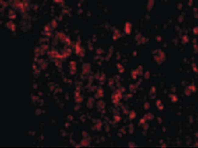 AVEN / PDCD12 Antibody - Immunofluorescence of AVEN in Human Spleen cells with AVEN antibody at 20 ug/ml.