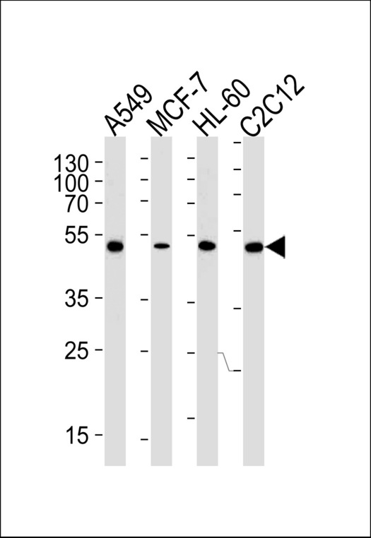 AVPR1A / V1a Receptor Antibody - AVPR1A Antibody western blot of A549,MCF-7,HL-60,mouse C2C12 cell line lysates (35 ug/lane). The AVPR1A antibody detected the AVPR1A protein (arrow).