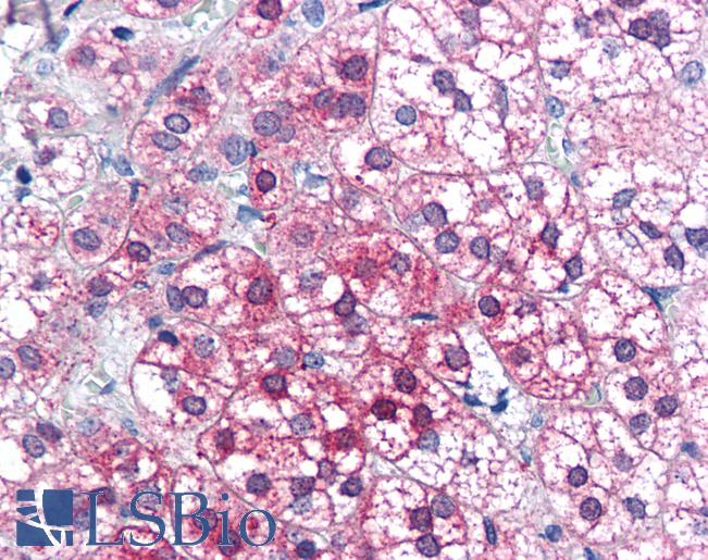 AXIN1 / Axin-1 Antibody - Anti-AXIN1 / AXIN antibody IHC of human adrenal. Immunohistochemistry of formalin-fixed, paraffin-embedded tissue after heat-induced antigen retrieval. Antibody concentration 75 ug/ml.