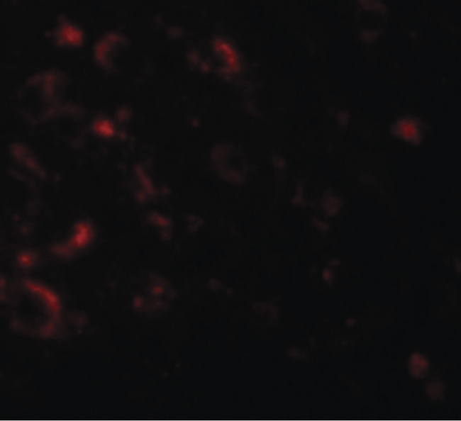 AXIN1 / Axin-1 Antibody - Immunofluorescence of AXIN1 in human brain tissue with AXIN1 antibody at 20 ug/ml.