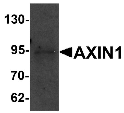 AXIN1 / Axin-1 Antibody - Western blot analysis of AXIN1 in SK-N-SH cell lysate with AXIN1 antibody at 1 ug/ml.