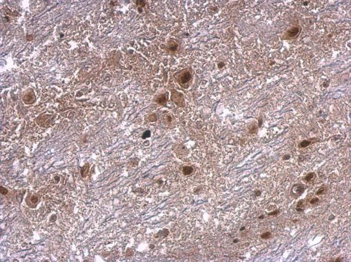 AXIN2 / Axin 2 Antibody - Anti-axin 2 antibody [N2C2], Internal used in IHC (Formalin-fixed paraffin-embedded sections).